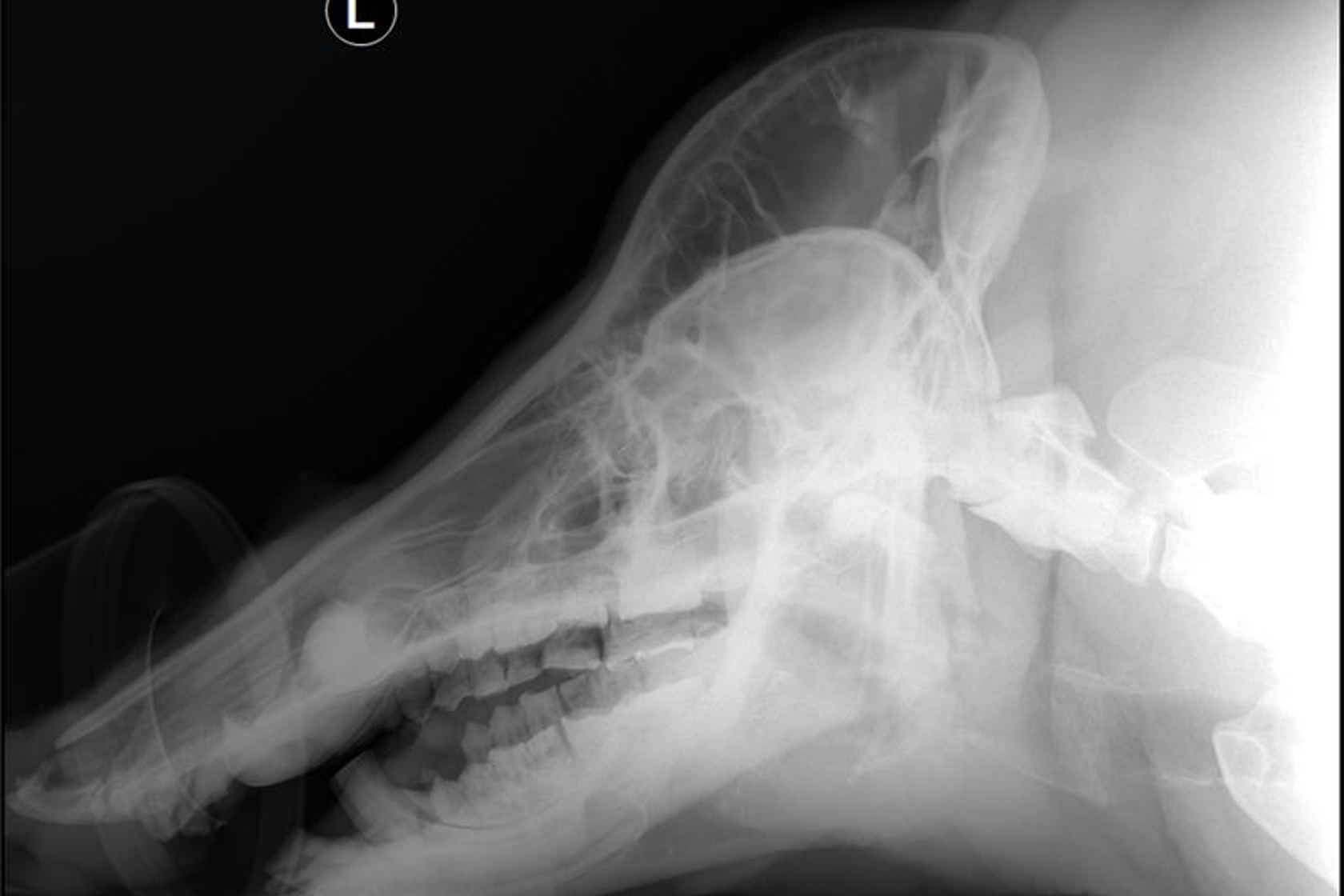 Xray